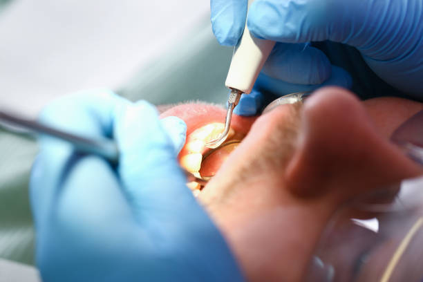 Best Dentist Open Late Near Me  in Meron Park, CA