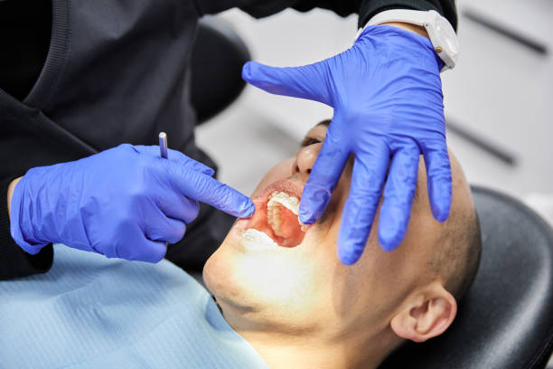 Best Cracked Tooth Emergency Dentist  in Meron Park, CA